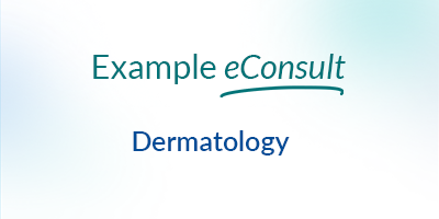 Dermatology Consult